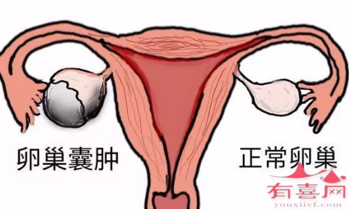 广州世纪助孕生殖中心正规吗